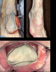Maksilofacijalna kirurgija 12