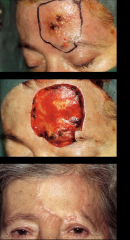 Maksilofacijalna kirurgija 7