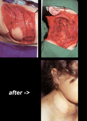 Maksilofacijalna kirurgija 9