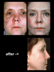 Maksilofacijalna kirurgija 18