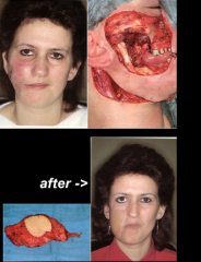 Maksilofacijalna kirurgija 13