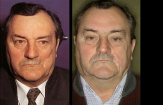 Maksilofacijalna kirurgija 17