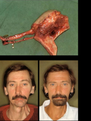 Maksilofacijalna kirurgija 16