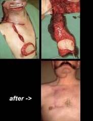 Maksilofacijalna kirurgija 10