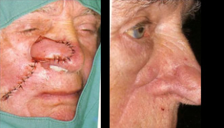 Maksilofacijalna kirurgija 6